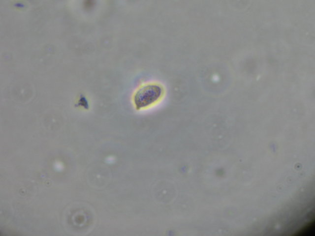 Botryobasidium con spore finemente verrucose